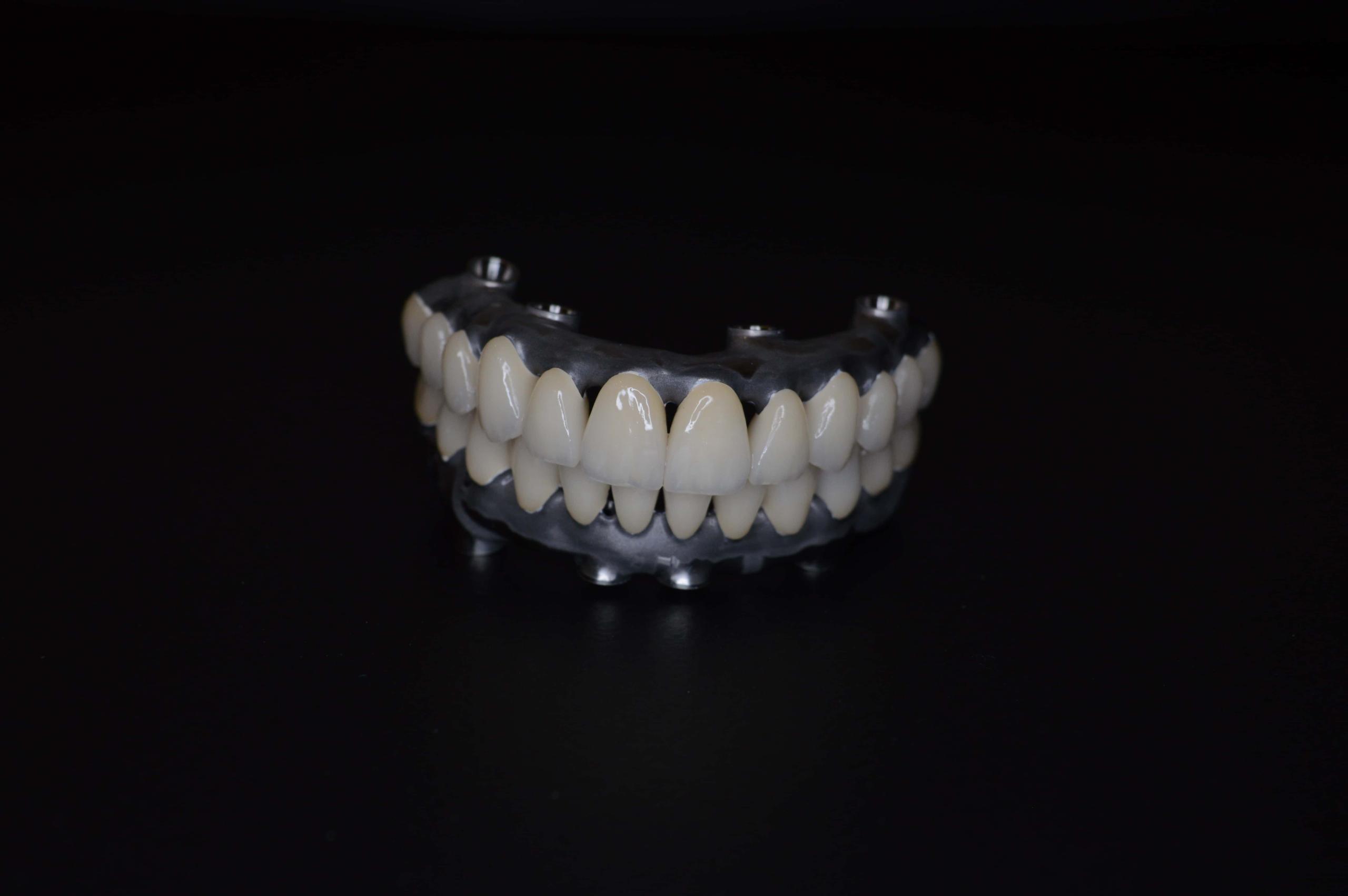 Detaliu tehnic al unei lucrări dentare din zirconiu