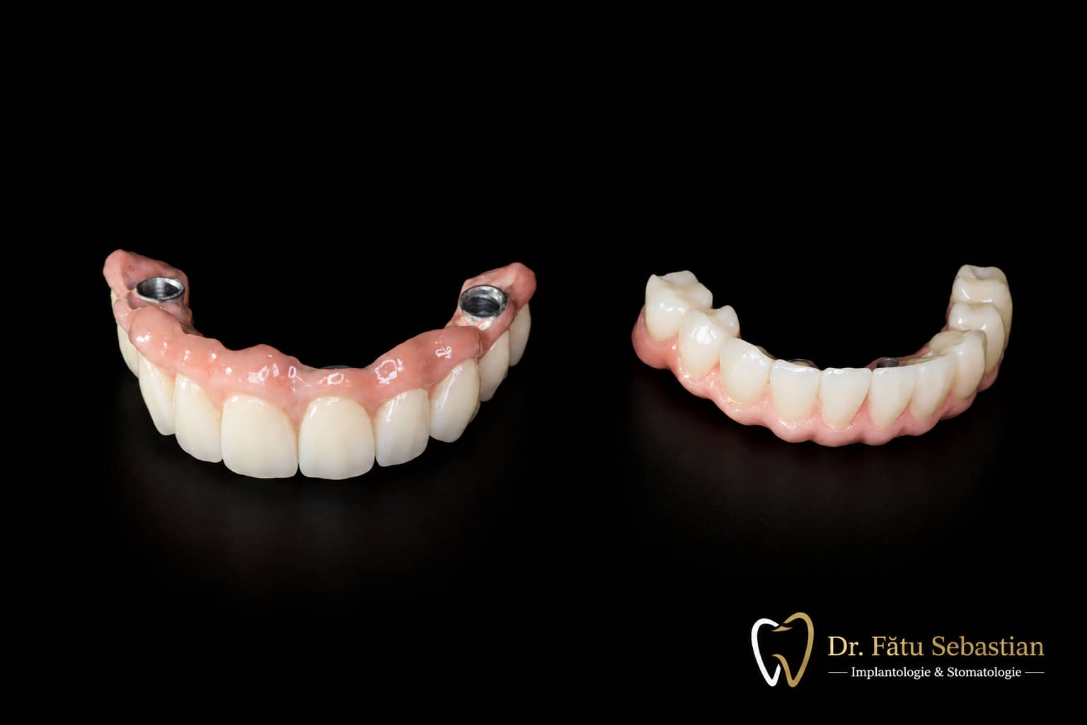 Lucrare dentară EMAX