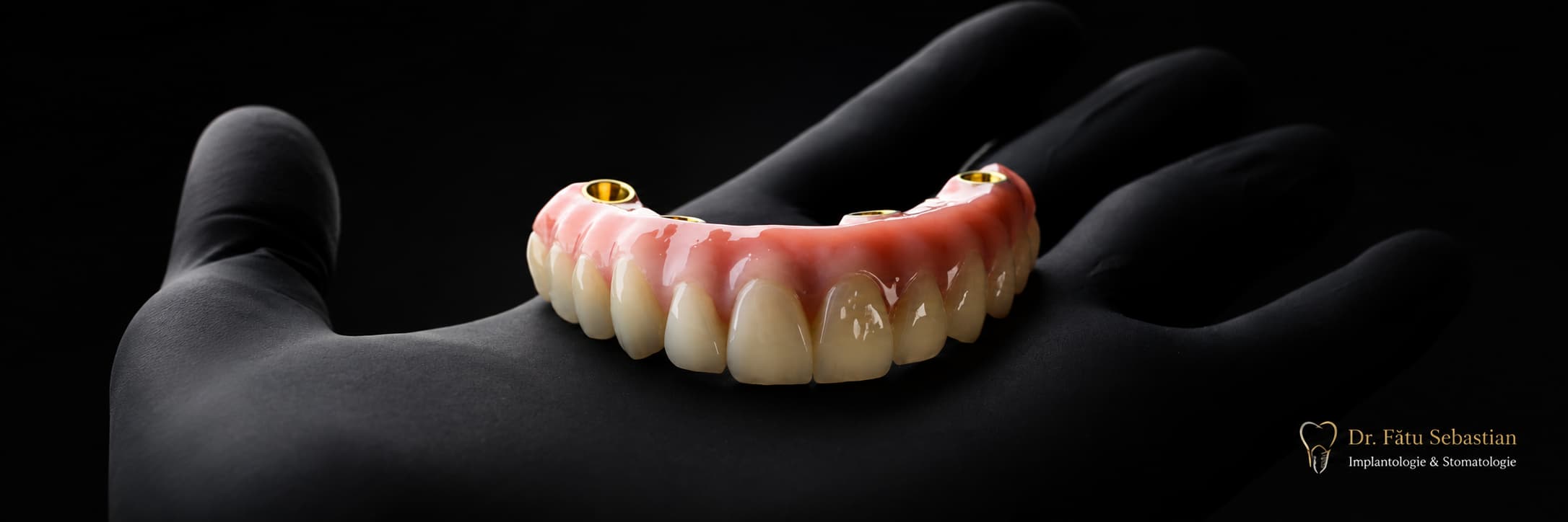Proteză dentară fixă din zirconiu pe implanturi dentare
