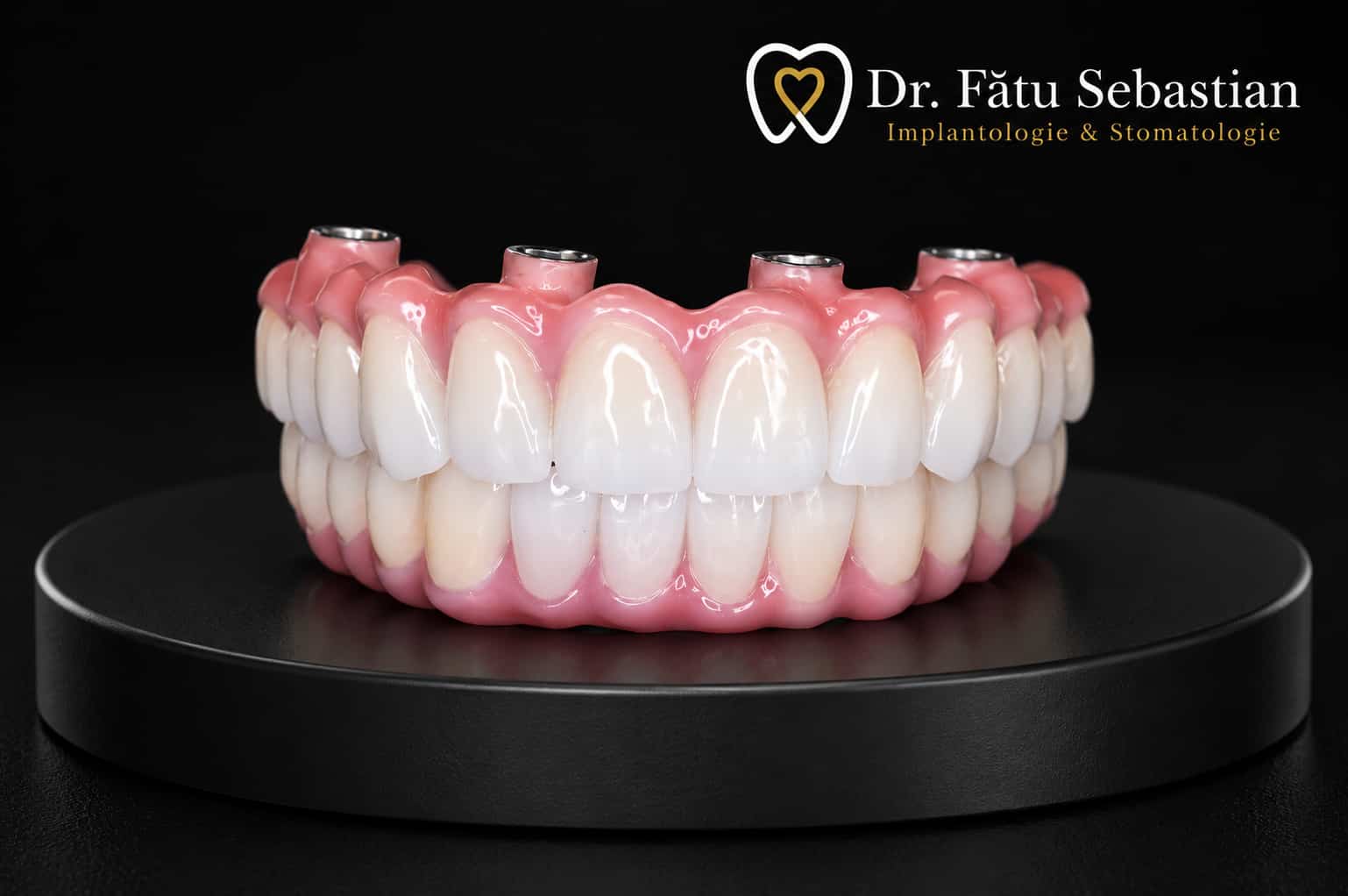 Proteză dentară fixă din zirconiu, realizată pentru un aspect natural